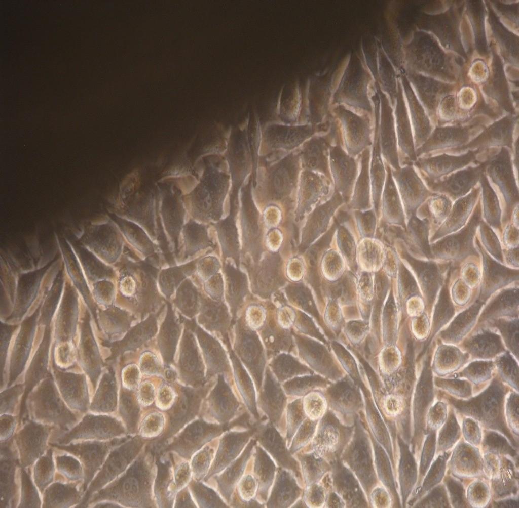 MG63 Human osteosarcoma Kultivační médium : MEM with Earle s Salts (without L- Glutamine)