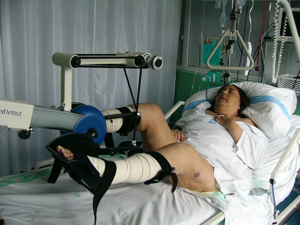 Obrázky 6, 7,8 Pulmonální rehabilitace zahrnující zejména pravidelnou