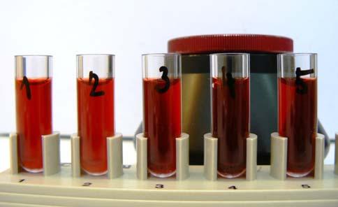 4.2.3. Příprava vzorku a postup SPE Do ultracentrifugační kyvety jsme napipetovali 500 l 5 mmol.l -1 HEPES (ph 7,4-7,5) a 500 l 50 mmol.l -1 D-mannitolu.