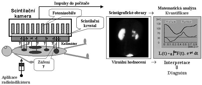 a jsou tedy do značné míry závislé na i zkušenostech a zručnosti obsluhy. 2.2.3 Scintigrafické vyšetření Názornou ukázku, jak scintigrafie probíhá, vidíme na obr. 2.4.