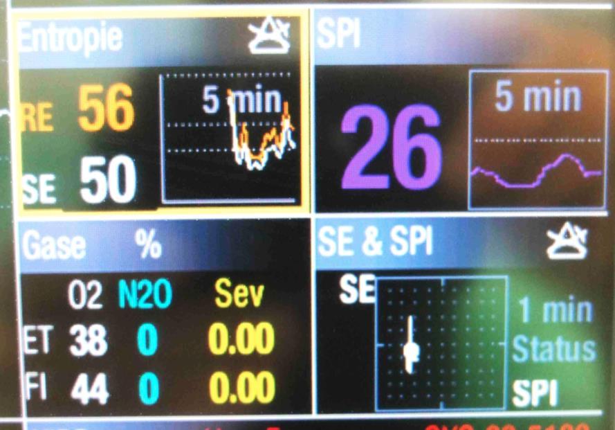 Entropie RE/SE + SPI = CNS +