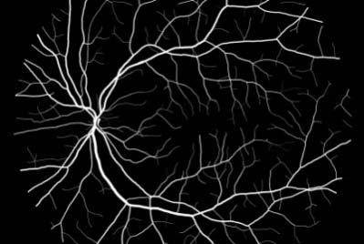 zdravých jedinců, tak jedinců s diabetickou retinopatií a glaukomem. Rozdělení snímků v HRF databázi je uvedeno v Tab.