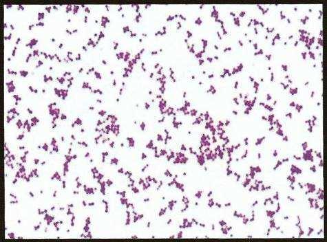 3.1.4.1.3 Rod Peptostreptococcus Jsou to grampozitivní, chemoorganotrofní, fermentatorní a anaerobní koky. Jsou sférické případně ovoidní, nepohyblivé a nesporující.