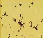 Mohou hrát úlohu u hnisavých infekcí (Sedláček, 2007). Obr. 8 Peptostreptococcus magnus Zdroj: Web 4 3.1.