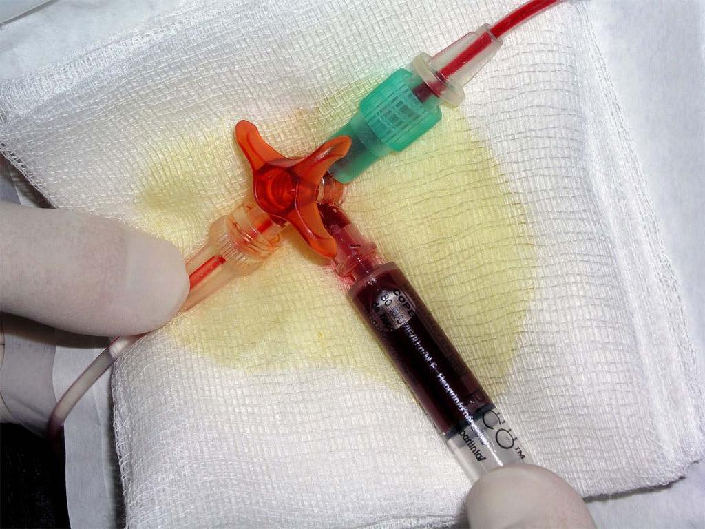 Metabolické a respirační poruchy acidobazické rovnováhy KAPITOLA 14,15,16 Obrázek 14.