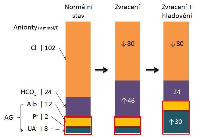 Kombinované poruchy acidobazické rovnováhy KAPITOLA 17 Obrázek 17.1 Vývoj kombinované poruchy ABR při zvracení a současném hladovění podle aniontů v séru; čísla uvádějí koncentraci iontů v mmol/l.