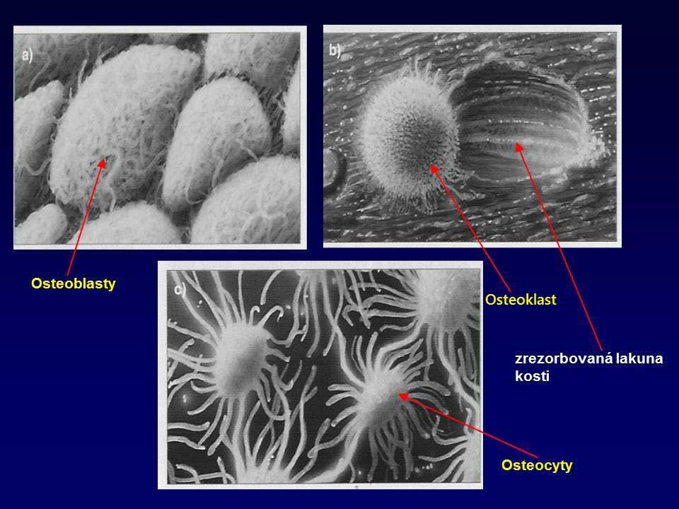 Kostní metabolizmus - příprava KAPITOLA 25 Osteoblast je základní buňka kostní novotvorby.