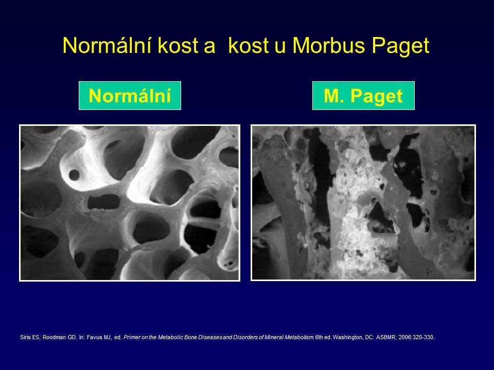Kostní metabolizmus Lab: zvýšená kostní remodelace, především hodnoty ALP, kalciofosfátový metabolizmus je většinou normální. KAPITOLA 25 Literatura: 1. RE.