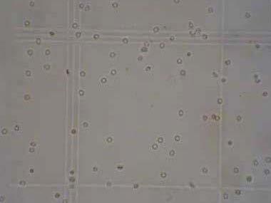 Cytochemické vyšetření mozkomíšního moku KAPITOLA 31 Obrázek 31.