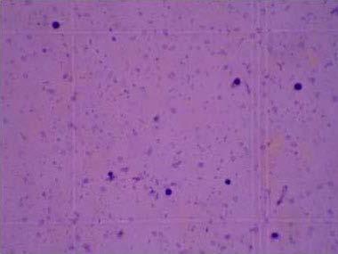 K přesnější diferenciaci elementů je potřeba zhotovit trvalý cytologický preparát. Základní barvicí metodou je barvení podle Pappenheima.
