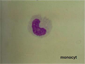 Cytochemické vyšetření mozkomíšního moku Plazmocyt Plazmocyty jsou konečným stadiem B-lymfocytů po imunologické stimulaci a produkují imunoglobuliny.