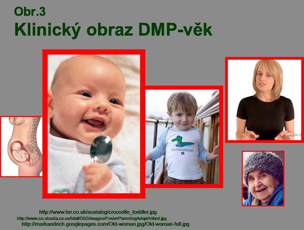 Dědičné poruchy metabolismu- laboratorní diagnostika