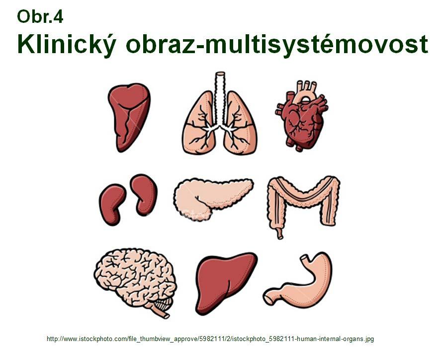 Dědičné poruchy metabolismu- laboratorní diagnostika KAPITOLA 32 Z tohoto důvodu se tak s klinickými projevy setkávají nejen dětští lékaři a internisté, ale také lékaři celé řady různých specializací