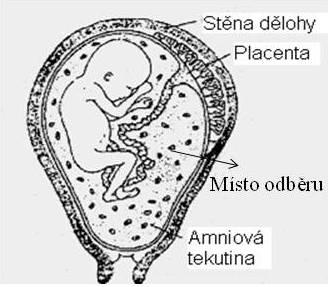 Laboratorní vyšetření v těhotenství integrovaný test PAPP-A (free β hcg) + AFP, hcg (ue3) sérum integrovaný test PAPP-A (free β hcg) + AFP, hcg (ue3) 0,8-1,2% 94% 2,7-5,2% 85% Tabulka 34.