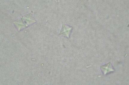 Záplava oxalátových krystalů může doprovázet otravu etylénglykolem (spolu s metabolickou acidózou, viz Toxikologie). Obrázek 5.10 Krystaly.
