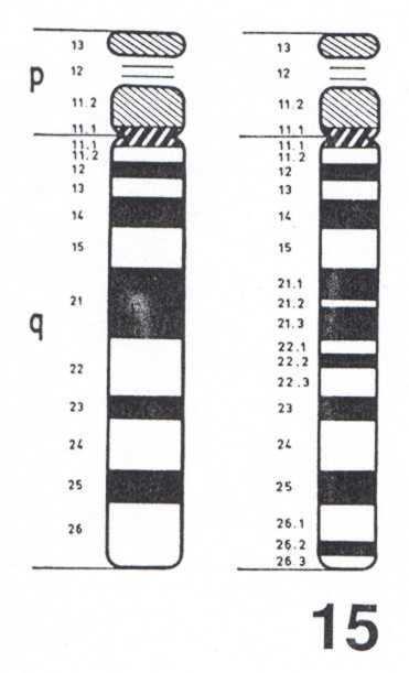 t(1;15) výměna