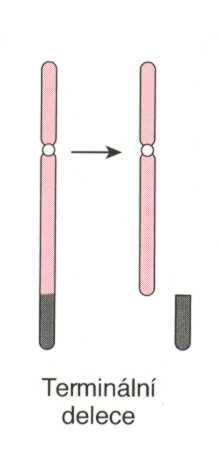 strukturní přestavby delece delece vznik zlomů a ztráta úseku chromosomu, který způsobuje vznik nebalancovaného karyotypu (parciální monosomie) na 1 chromosomu v páru úsek přítomen je, na druhém