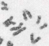 ROZESTUP SESTERSKÝCH CHROMATID V ANAFÁZI MITÓZY M fáze = MITÓZA chromosomy v anafázi mitózy