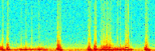 Frequency Mitrální stenóza.5 -.5-1.2.4.6.8 1 1.2 1.4 1.