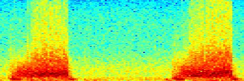 Frequency Mitrální regurgitace.5 -.5-1.2.4.6.8 1 1.2 1.