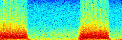 Frequency Mitrální regurgitace.5 -.5-1.2.4.6.8 1 1.2 1.