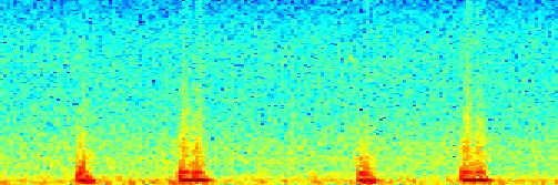 Frequency Defekt síňového septa.5 -.5-1.2.4.6.8 1 1.2 1.4 1.6 1.