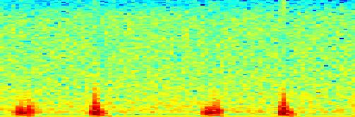 Frequency Koarktace aorty.2.1 -.1 -.2.1.2.3.4.5.6.