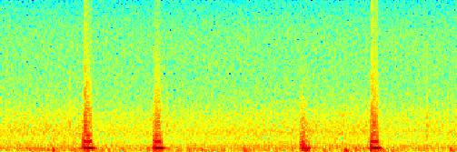Frequency AV blokáda.5 -.5-1.5 1 1.5 2 2.5 3 3.5 5 4 3 2 1.