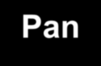 Pan-Tompkinsonův algoritmus nalezení