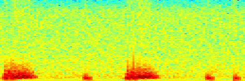 Frequency Aortální insuficience.4.2 -.2.2.4.6.8 1 1.2 1.