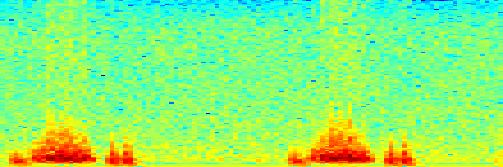 Frequency Pulmonální stenóza.5 -.5.2.4.6.8 1 1.