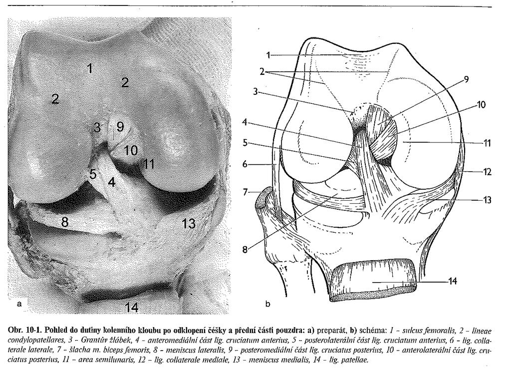 Příloha I: Anatomie kolenního kloubu Obr. 1. Pohled do dutiny kolenního kloubu po odklopení čéšky a přední části pouzdra (Podle: Bartoníček, ).