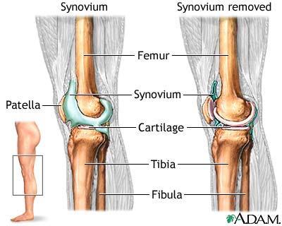Obr. č. 3 Anatomické struktury kolenního kloubu synoviální membrána [20] Synoviální tekutinu (synovii) secernuje synoviální membrána.