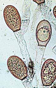 Chytridiomycota Rhizophydium - eukarpická stélka na pylovém