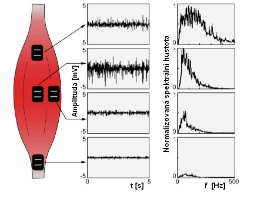 úplně na okraj svalu, amplituda výsledného signálu by se rovnala nule.