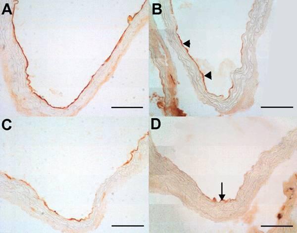 Obrázek 11. Exprese VCAM-1 v endotelu aortálního sinu cholesterolové skupiny zvířat (A) a skupiny, které byl podáván atorvastatin (B). Exprese je pozorována pouze v endoteliálních buňkách (viz.