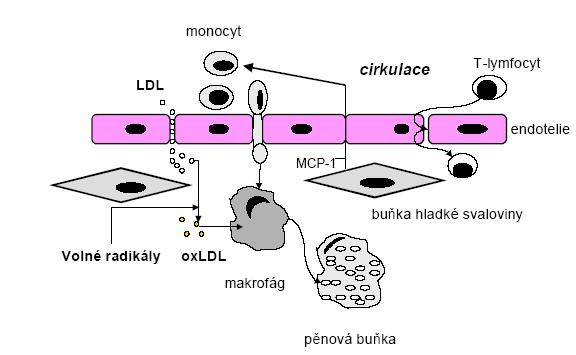 Obrázek 3. Schéma počáteční fáze dysfunkce endotelu (převzato z internetových stránek: http://www.zdravcentra.sk/index.php?