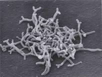 2. Bakteriální kmeny 2.1 Rod BIFIDOBACTERIUM Je to rod grampozitivních, přísně anaerobních bakterií, které mají tvar do písmene V nebo Y.