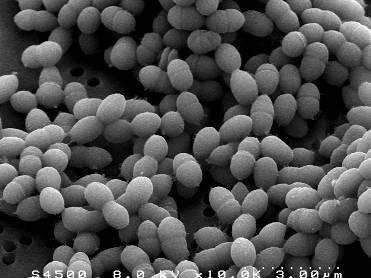 Lactobacillus rhamnosus Zpomaluje růst škodlivých bakterií v trávicím traktu člověka. Pomáhá obnovovat střevní rovnováhu, podporuje obranné funkce a zlepšuje adaptivní imunitu.