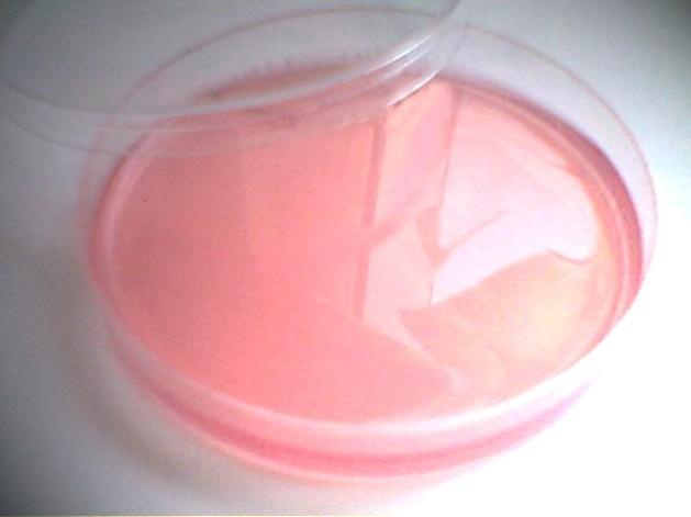 Použití agaru Příprava bakteriálních ţivných půd agarosové gely pro