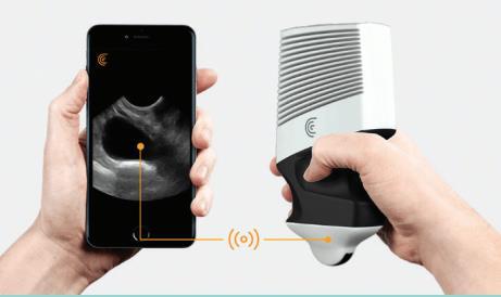 Obr. 3. Smartphone ultrasound scanner. Trojrozměrné a čtyřrozměrné zobrazení zahrnuje využití speciálních volumetrických sond, které jsou schopny generovat trojrozměrné ultrazvukové pole (Hrazdira L.