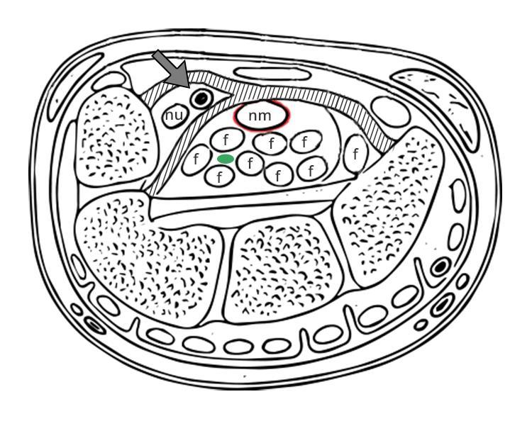 Obr. 15.