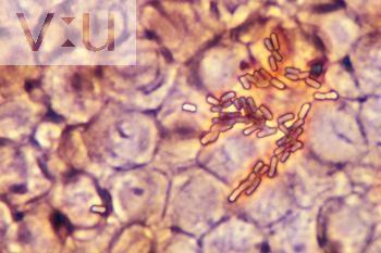 E. coli v hemokultuře, fázový kontrast