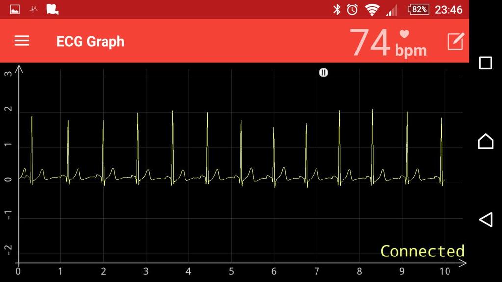 6.2.5. EKG graf Aplikace poskytuje funkci vizualizace probíhajícího měření a BPM, která se vyvolá nabídkou z menu aplikace (ECG Graph) nebo kliknutím na ikonku srdce na úvodní obrazovce.