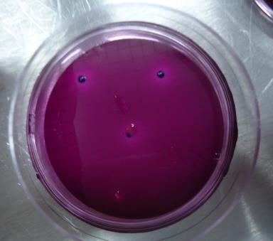 Obr. č. 8 Pracovní postup při membránové filtraci http://classroom.sdmesa.edu/eschmid/lecture4-microbio.htm Kultivace Membránové filtry po filtraci se položí na povrch Endo agaru.