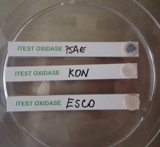 Materiál: Testovací proužky ITEST OXIDASA (ITEST plus, s.r.o.) Neznámý mikroorganismus Kontrolní kmen Pseudomonas aeruginosa Postup: Proužek ITEST OXIDASA se mírně navlhčí sterilním fyziologickým roztokem.