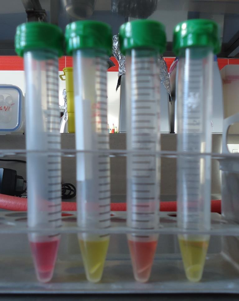 Materiál: Neznámý mikroorganismus Bakteriologická klička Skleněné sterilní zkumavky s 1 ml fyziologického roztoku 2 ks ITEST TRIBUTYRIN 2 ks Postup: Bakteriologickou kličkou se odebere suspenze