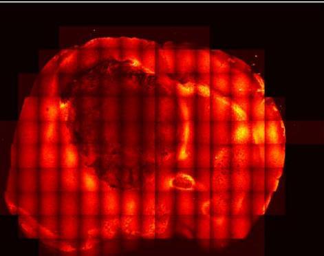 epi-cars microscopy We used epi-cars microscopy to image ex vivo mouse brain tissues. Epi-CARS microscopy suppresses the nonresonant background from the aqueous medium.