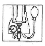 vypuďte vzduch z infuzního zařízení - zavřete svorku Vložte nádobu do tlakové manžety