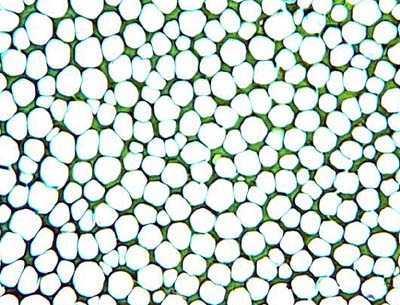 Angular collenchyma in